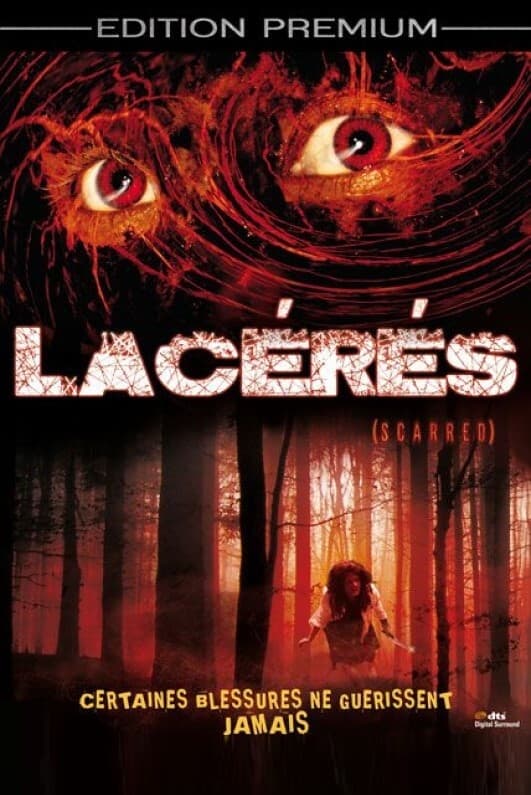 Lacérés