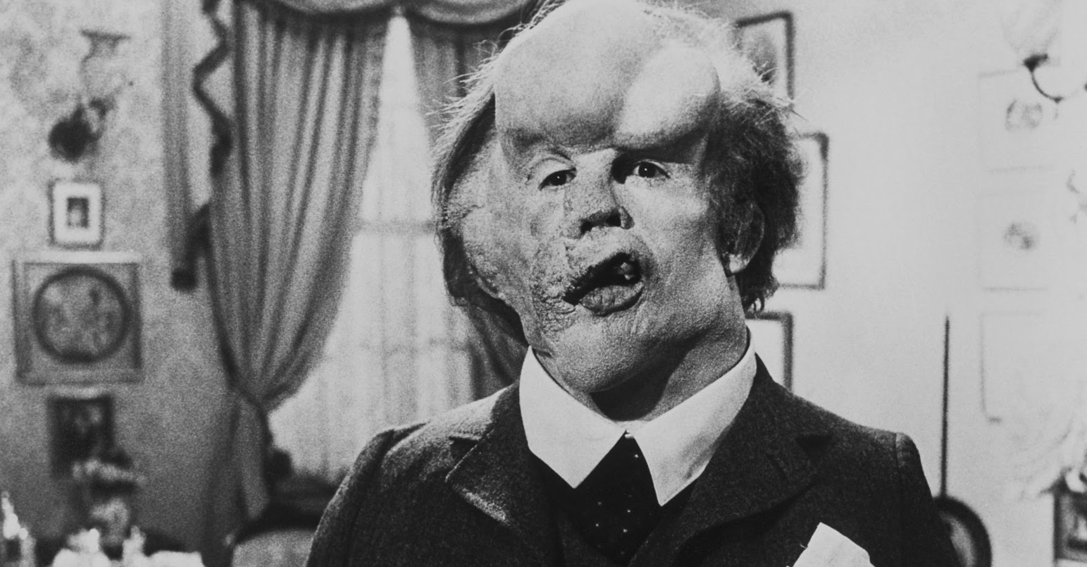Elephant Man sur Netflix : de quelle maladie souffrait John ?