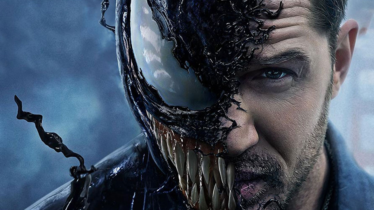 Venom : Tom Hardy a dû se faire opérer après le tournage