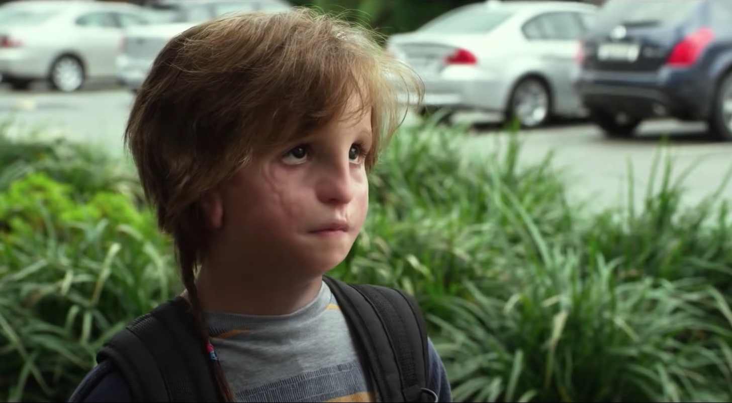 Wonder : de quelle maladie souffre le jeune Auggie, joué par Jacob Tremblay ?