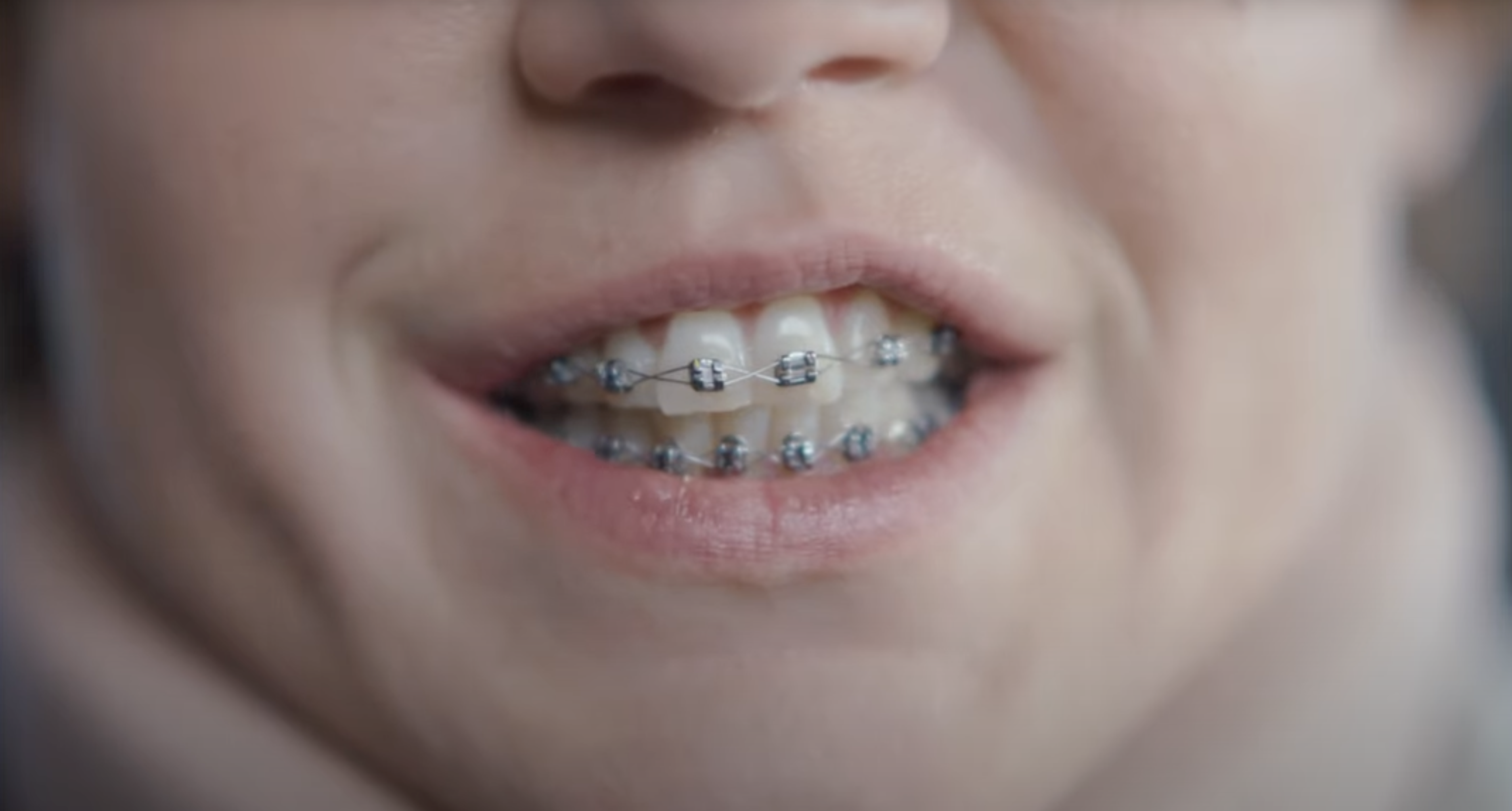 Adèle Exarchopoulos est méconnaissable dans les premières images de ce film